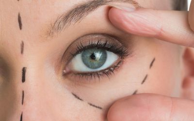 What to Expect When Getting Dermal Fillers
