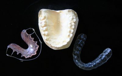 Benefits of Going to Your Dentist for a Mouth Guard