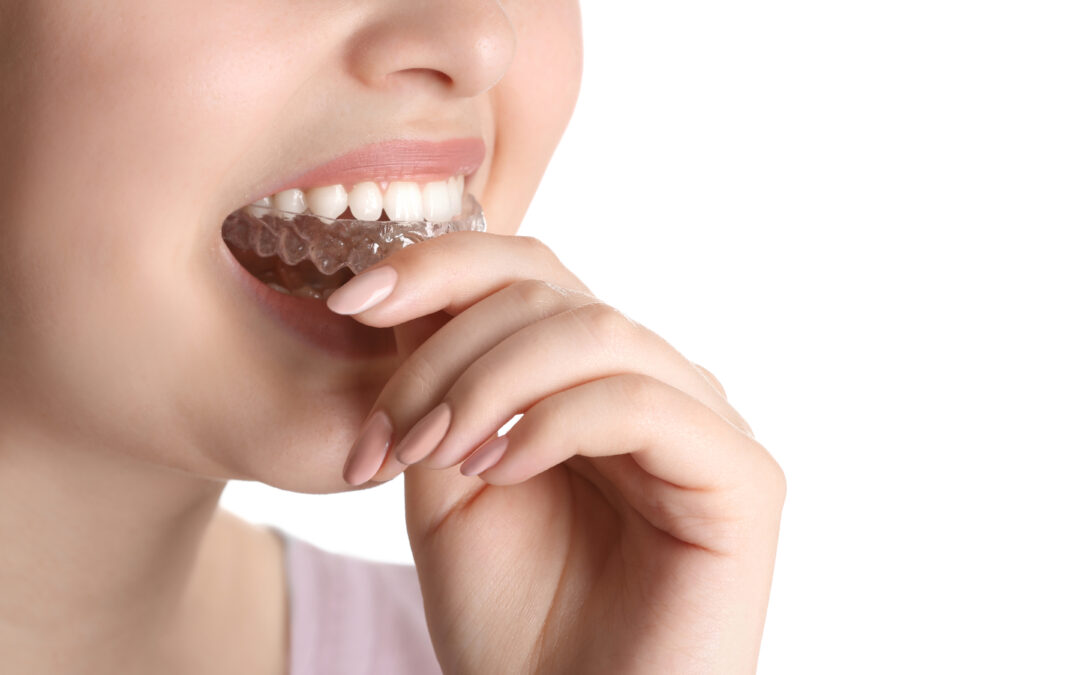 Teeth Grinding: How to Stop Grinding My Teeth
